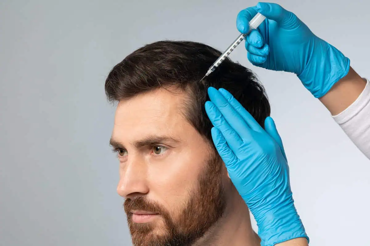 The Benefits of Choosing Professional Hair Restoration Services