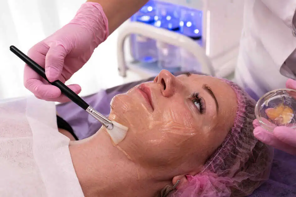 Why Chemical Peels Are a Must-Have Treatment for Glowing Skin