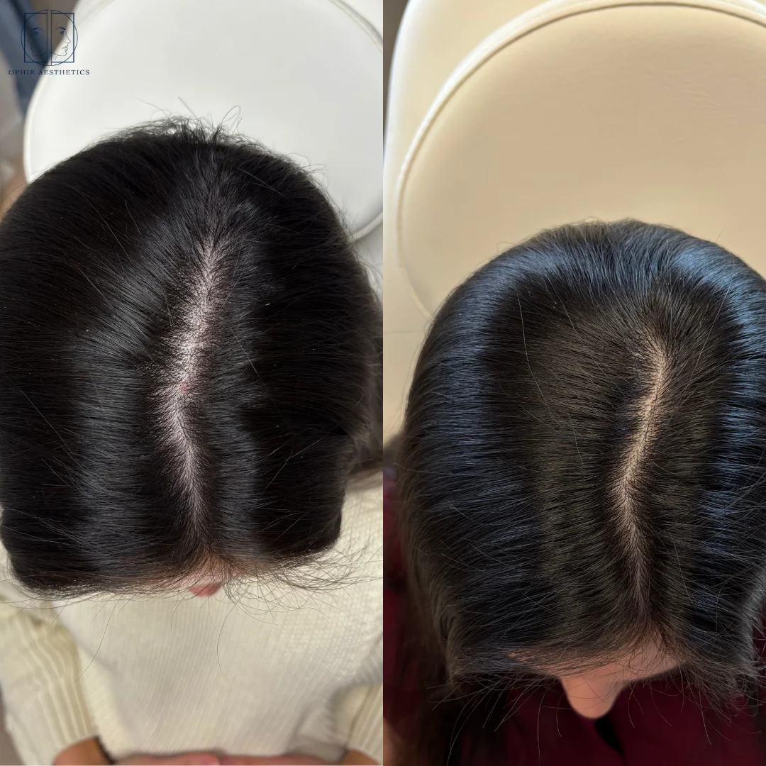 hair-restoration-before-after-two
