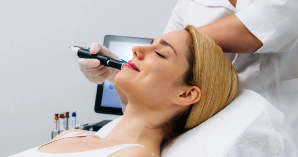 Current image: Woman receiving microneedling in Lake Stevens WA at a professional aesthetics clinic.